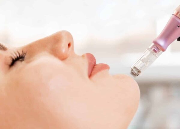 Higiene Facial con Punta de Diamante + Dermapen